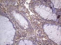 NUDT12 Mouse anti-Human, Clone: OTI2G2, lyophilized, TrueMAB 100 &mu;g;