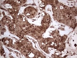 NUDT12 Mouse anti-Human, Clone: OTI2G2, lyophilized, TrueMAB 100 &mu;g;