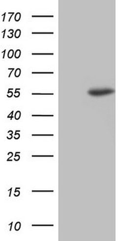 NUDT12 Mouse anti-Human, Clone: OTI1B7, lyophilized, TrueMAB 100 &mu;g;