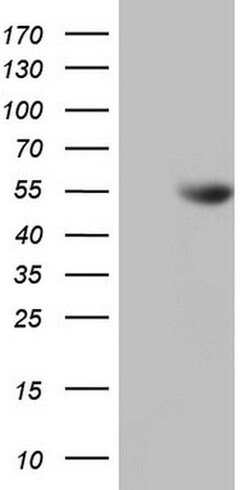 NUDT12 Monoclonal Antibody (OTI5B6), TrueMAB , OriGene 100 &mu;L; Unconjugated:Antibodies,