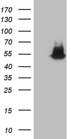 NUDT12 Mouse anti-Human, Clone: OTI7G5, lyophilized, TrueMAB 100 &mu;g;