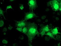 NUDT18 Monoclonal Antibody (OTI5D7), TrueMAB , OriGene 30 &mu;L; Unconjugated:Antibodies,