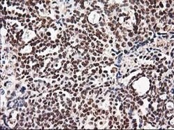 NUDT18 Monoclonal Antibody (OTI5D7), TrueMAB , OriGene 30 &mu;L; Unconjugated:Antibodies,