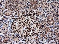 NUDT18 Monoclonal Antibody (OTI5D7), TrueMAB , OriGene:Antibodies:Primary