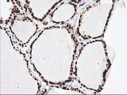 NUDT18 Monoclonal Antibody (OTI5D7), TrueMAB , OriGene 30 &mu;L; Unconjugated:Antibodies,