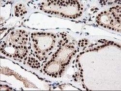 NUDT18 Monoclonal Antibody (OTI5D7), TrueMAB , OriGene 30 &mu;L; Unconjugated:Antibodies,