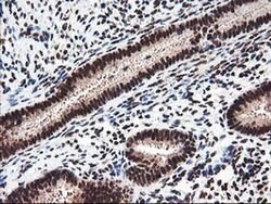 NUDT18 Monoclonal Antibody (OTI5D7), TrueMAB , OriGene 30 &mu;L; Unconjugated:Antibodies,