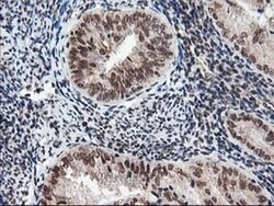 NUDT18 Monoclonal Antibody (OTI5D7), TrueMAB , OriGene 30 &mu;L; Unconjugated:Antibodies,