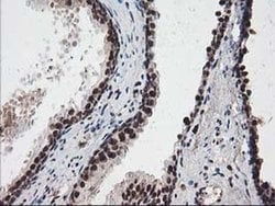 NUDT18 Monoclonal Antibody (OTI5D7), TrueMAB , OriGene:Antibodies:Primary