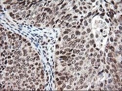 NUDT18 Monoclonal Antibody (OTI5D7), TrueMAB , OriGene 30 &mu;L; Unconjugated:Antibodies,