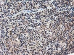 NUDT18 Monoclonal Antibody (OTI5D7), TrueMAB , OriGene 30 &mu;L; Unconjugated:Antibodies,