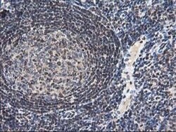 NUDT18 Monoclonal Antibody (OTI5D7), TrueMAB , OriGene 30 &mu;L; Unconjugated:Antibodies,