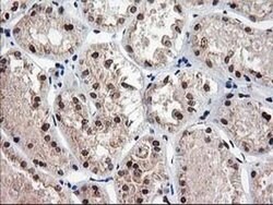 NUDT18 Monoclonal Antibody (OTI5D7), TrueMAB , OriGene 30 &mu;L; Unconjugated:Antibodies,