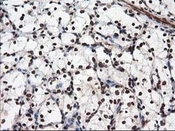 NUDT18 Monoclonal Antibody (OTI5D7), TrueMAB , OriGene 30 &mu;L; Unconjugated:Antibodies,