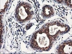 NUDT18 Monoclonal Antibody (OTI5F9), TrueMAB , OriGene 100 &mu;L; Unconjugated:Antibodies,