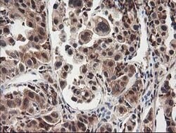 NUDT18 Mouse anti-Human, Clone: OTI5F9, lyophilized, TrueMAB 100 &mu;g;