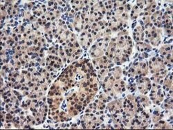 NUDT18 Mouse anti-Human, Clone: OTI5F9, lyophilized, TrueMAB 100 &mu;g;