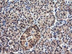 NUDT18 Monoclonal Antibody (OTI5F9), TrueMAB , OriGene 100 &mu;L; Unconjugated:Antibodies,