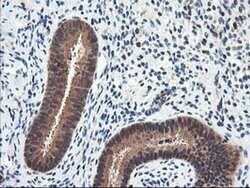 NUDT18 Monoclonal Antibody (OTI5F9), TrueMAB , OriGene 100 &mu;L; Unconjugated:Antibodies,