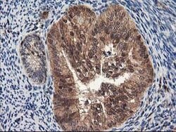 NUDT18 Mouse anti-Human, Clone: OTI5F9, lyophilized, TrueMAB 100 &mu;g;