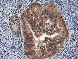 NUDT18 Monoclonal Antibody (OTI5F9), TrueMAB , OriGene 100 &mu;L; Unconjugated:Antibodies,