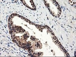 NUDT18 Mouse anti-Human, Clone: OTI5F9, lyophilized, TrueMAB 100 &mu;g;