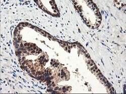 NUDT18 Monoclonal Antibody (OTI5F9), TrueMAB , OriGene 100 &mu;L; Unconjugated:Antibodies,