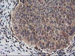 NUDT18 Mouse anti-Human, Clone: OTI5F9, lyophilized, TrueMAB 100 &mu;g;