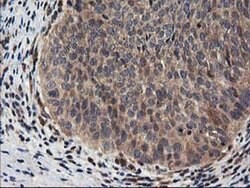 NUDT18 Monoclonal Antibody (OTI5F9), TrueMAB , OriGene 100 &mu;L; Unconjugated:Antibodies,