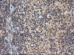 NUDT18 Mouse anti-Human, Clone: OTI5F9, lyophilized, TrueMAB 100 &mu;g;