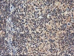 NUDT18 Monoclonal Antibody (OTI5F9), TrueMAB , OriGene 100 &mu;L; Unconjugated:Antibodies,
