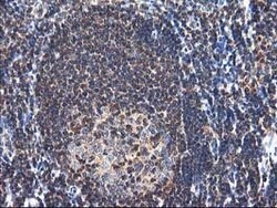 NUDT18 Mouse anti-Human, Clone: OTI5F9, lyophilized, TrueMAB 100 &mu;g;