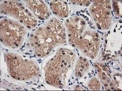 NUDT18 Mouse anti-Human, Clone: OTI5F9, lyophilized, TrueMAB 100 &mu;g;