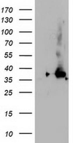 NUDT18 Monoclonal Antibody (OTI5D7), TrueMAB , OriGene 30 &mu;L; Unconjugated:Antibodies,