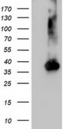 NUDT18 Mouse anti-Human, Clone: OTI5F9, lyophilized, TrueMAB 100 &mu;g;