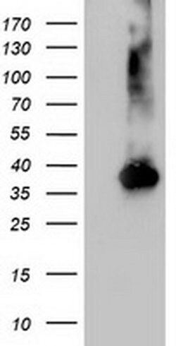 NUDT18 Monoclonal Antibody (OTI5F9), TrueMAB , OriGene 100 &mu;L; Unconjugated:Antibodies,