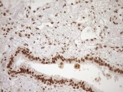 NUDT21 Monoclonal Antibody (OTI2C8), TrueMAB , OriGene 100 &mu;L; Unconjugated:Antibodies,