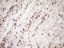 NUDT21 Monoclonal Antibody (OTI2C8), TrueMAB , OriGene 100 &mu;L; Unconjugated:Antibodies,