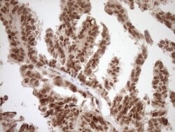 NUDT21 Monoclonal Antibody (OTI2C8), TrueMAB , OriGene 100 &mu;L; Unconjugated:Antibodies,