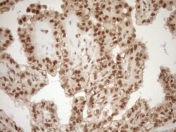 NUDT21 Monoclonal Antibody (OTI2C8), TrueMAB , OriGene 100 &mu;L; Unconjugated:Antibodies,