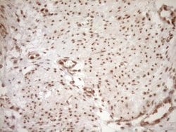 NUDT21 Monoclonal Antibody (OTI2C8), TrueMAB , OriGene 100 &mu;L; Unconjugated:Antibodies,