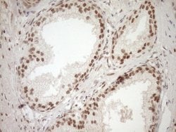 NUDT21 Monoclonal Antibody (OTI2C8), TrueMAB , OriGene 100 &mu;L; Unconjugated:Antibodies,