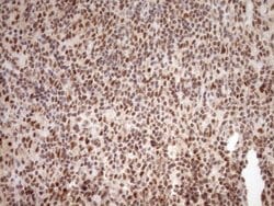 NUDT21 Monoclonal Antibody (OTI2C8), TrueMAB , OriGene 100 &mu;L; Unconjugated:Antibodies,