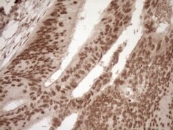 NUDT21 Monoclonal Antibody (OTI2C8), TrueMAB , OriGene 100 &mu;L; Unconjugated:Antibodies,
