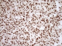 NUDT21 Monoclonal Antibody (OTI2C8), TrueMAB , OriGene 100 &mu;L; Unconjugated:Antibodies,