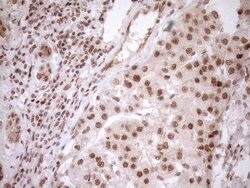 NUDT21 Monoclonal Antibody (OTI2C8), TrueMAB , OriGene 100 &mu;L; Unconjugated:Antibodies,