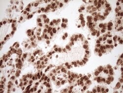 NUDT21 Monoclonal Antibody (OTI5B3), TrueMAB , OriGene 100 &mu;L; Unconjugated:Antibodies,