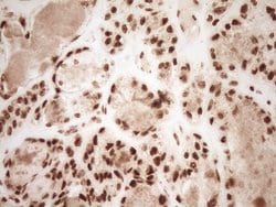 NUDT21 Monoclonal Antibody (OTI5B3), TrueMAB , OriGene 100 &mu;L; Unconjugated:Antibodies,