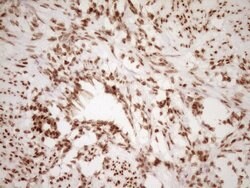 NUDT21 Monoclonal Antibody (OTI5B3), TrueMAB , OriGene 100 &mu;L; Unconjugated:Antibodies,