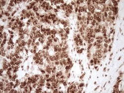 NUDT21 Monoclonal Antibody (OTI5B3), TrueMAB , OriGene 100 &mu;L; Unconjugated:Antibodies,